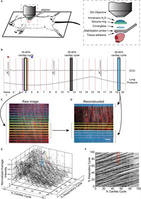 In Vivo Calcium Imaging of Cardiomyocytes in the Beating Mouse Heart With Multiphoton Microscopy